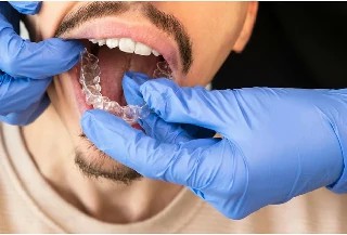 Curso Online Básico em Odontologia Estética